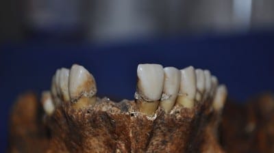 Dental cementum, which holds teeth in their sockets, can help determine the season in which a person died. (Photo courtesy of Jackson County Medical Examiner).